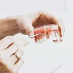 How Much Do Dental Implants Cost in the UK? A Complete Guide