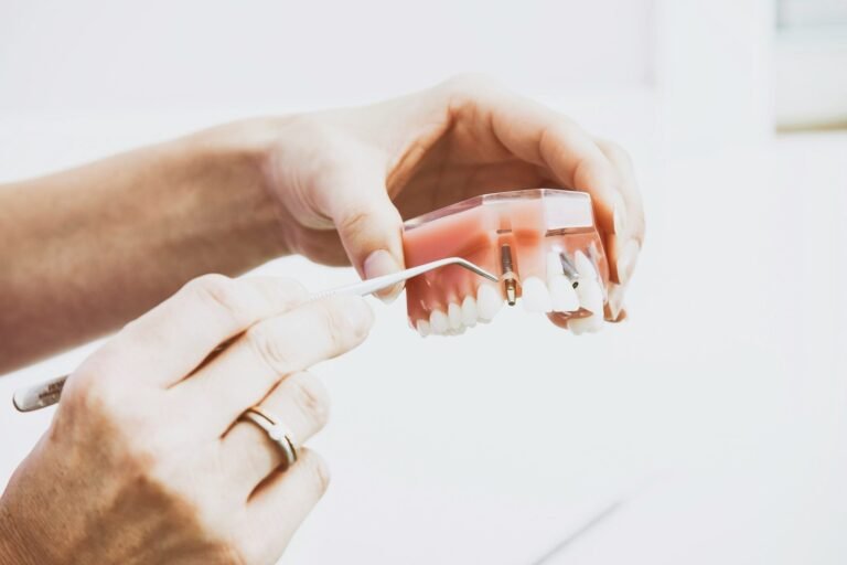 How Much Do Dental Implants Cost in the UK? A Complete Guide