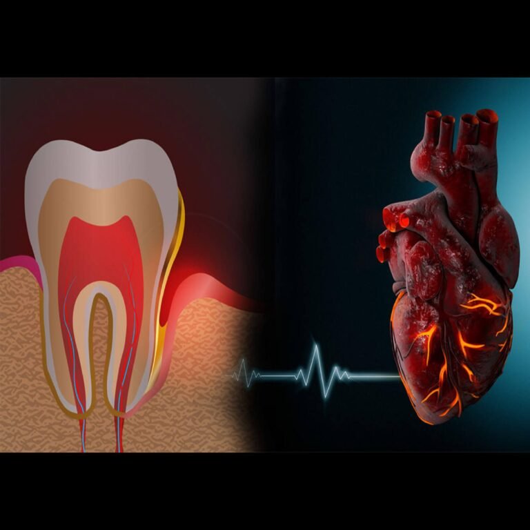 Image of Gum Disease and Heart Health: The Connection