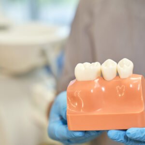Dental hygienist holding a dental model at Ashtead Dental