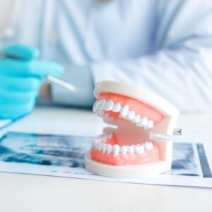 Dental consultation with treatment model at Ashtead Dental