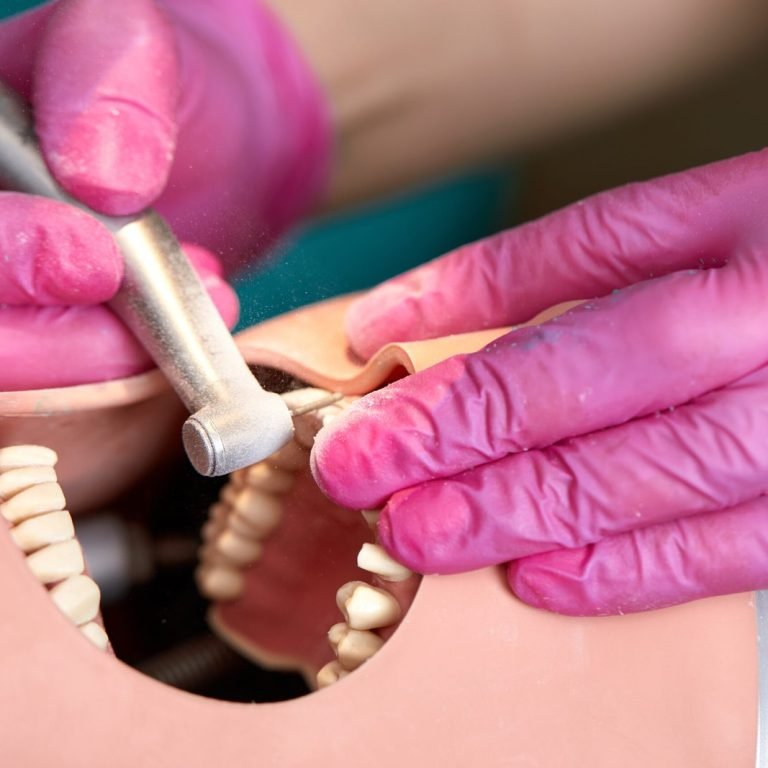 Bone-Grafting-ashtead