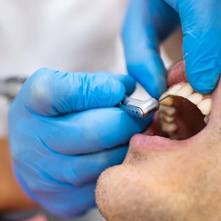 Tooth-Extraction