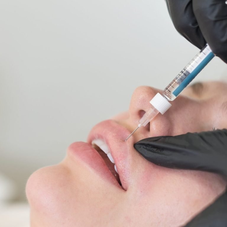 dermal-fillers-ashtead