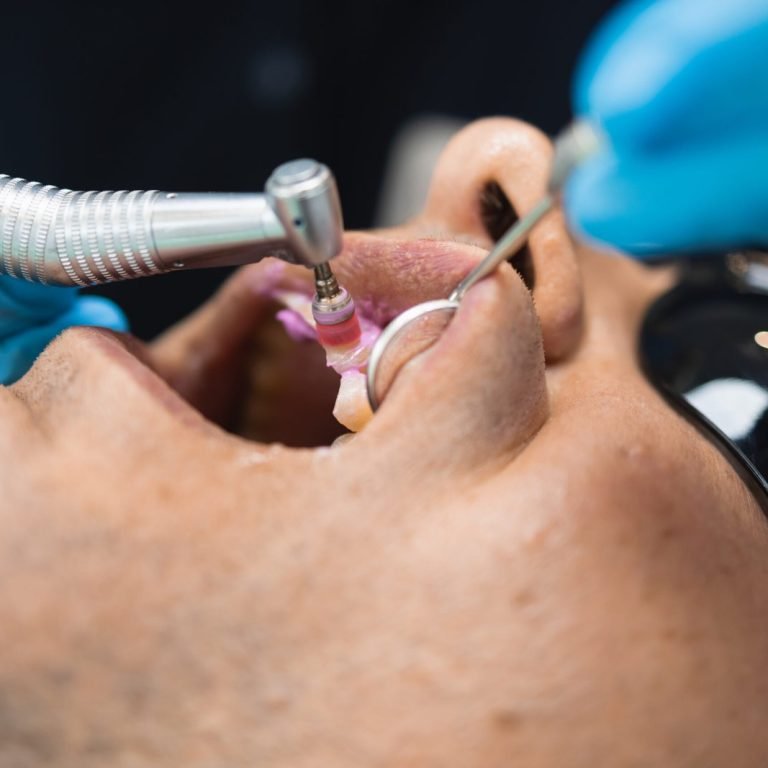 gum-disease
